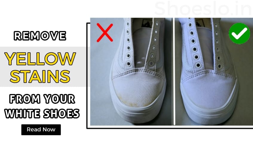 Remove yellow stains from white shoes